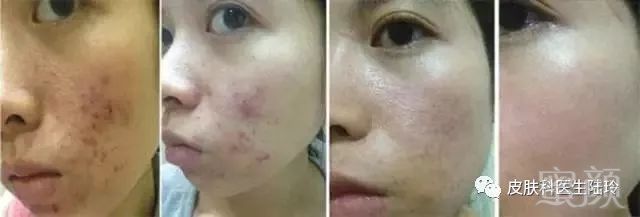 https://img.miyanlife.com/mnt/timg/180503/124HT2H-5.jpg