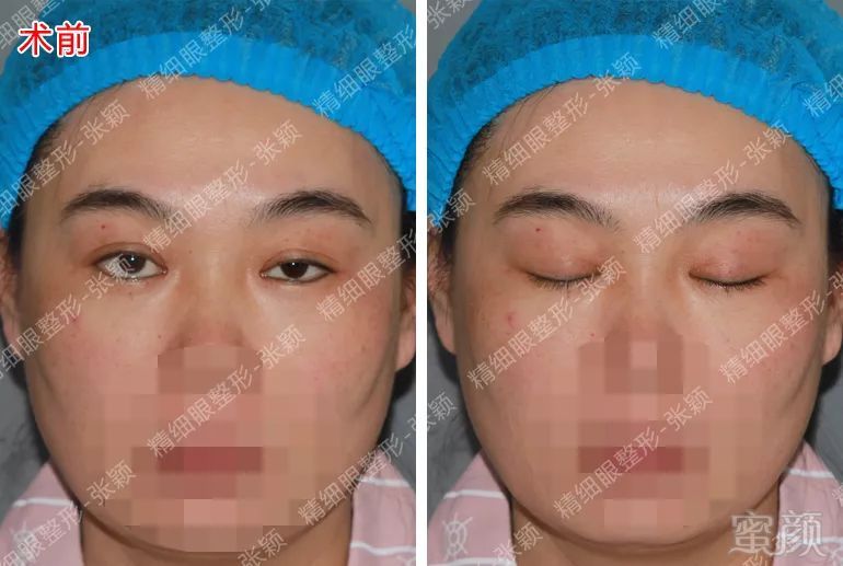 https://img.miyanlife.com/mnt/timg/180503/124Z45045-3.jpg