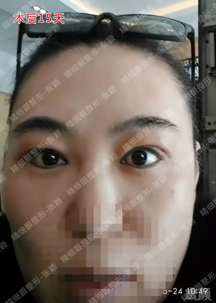 https://img.miyanlife.com/mnt/timg/180503/124Z61961-6.jpg