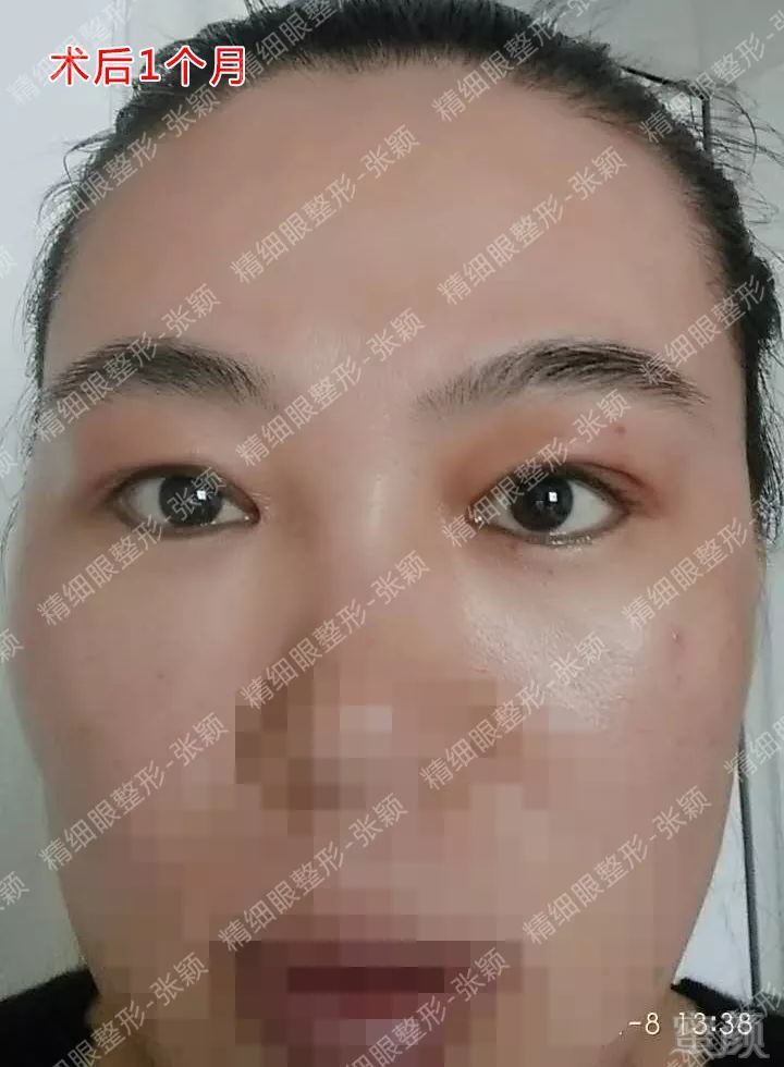 https://img.miyanlife.com/mnt/timg/180503/124ZA3U-7.jpg
