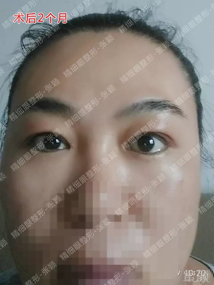 https://img.miyanlife.com/mnt/timg/180503/124ZB239-8.jpg