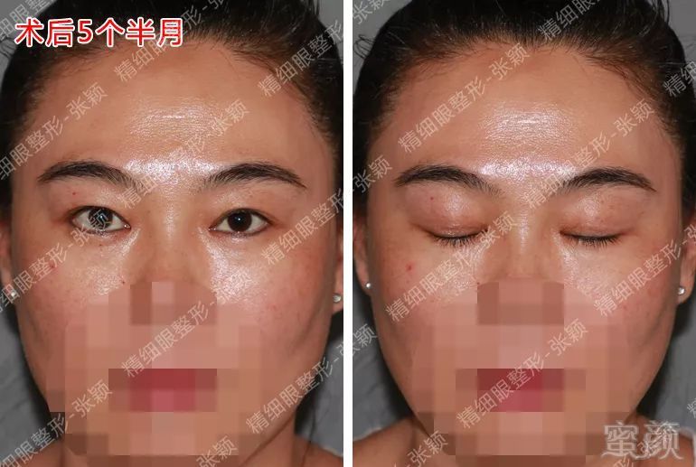 https://img.miyanlife.com/mnt/timg/180503/124ZG122-10.jpg