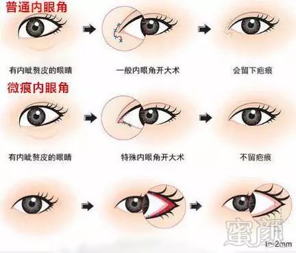 https://img.miyanlife.com/mnt/timg/180503/125112N45-1.jpg