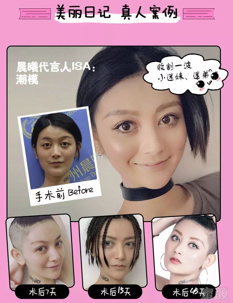 https://img.miyanlife.com/mnt/timg/180503/125115B10-6.jpg