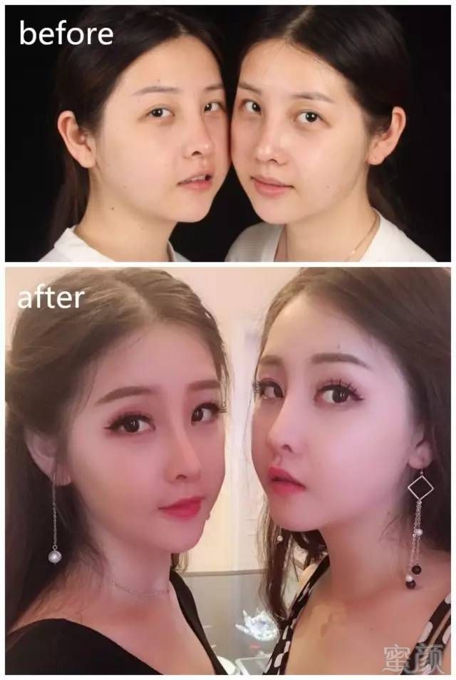https://img.miyanlife.com/mnt/timg/180503/12523B338-2.jpg