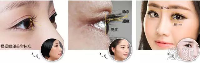 https://img.miyanlife.com/mnt/timg/180503/12523V232-3.jpg