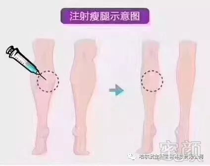 https://img.miyanlife.com/mnt/timg/180503/1254342154-1.jpg