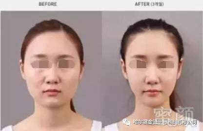 https://img.miyanlife.com/mnt/timg/180503/125434C33-4.jpg