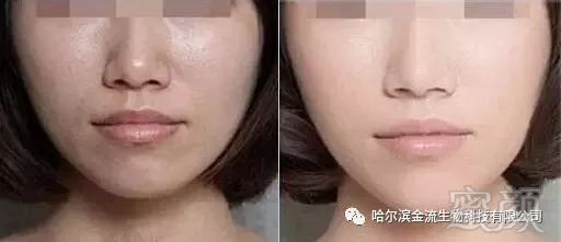 https://img.miyanlife.com/mnt/timg/180503/1254351615-6.jpg