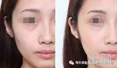 https://img.miyanlife.com/mnt/timg/180503/1254351R4-7.jpg