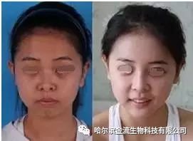 https://img.miyanlife.com/mnt/timg/180503/1254352518-8.jpg