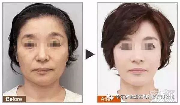 https://img.miyanlife.com/mnt/timg/180503/1254355c8-10.jpg