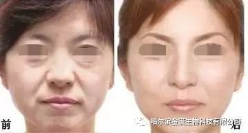 https://img.miyanlife.com/mnt/timg/180503/12543C141-11.jpg