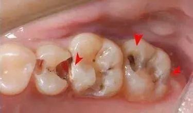 https://img.miyanlife.com/mnt/timg/180503/12560J507-2.jpg