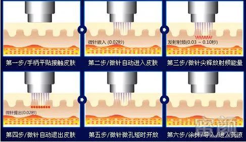 案例图片