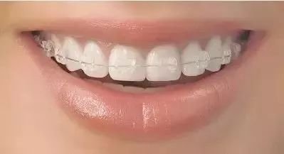 https://img.miyanlife.com/mnt/timg/180506/1244403437-7.jpg
