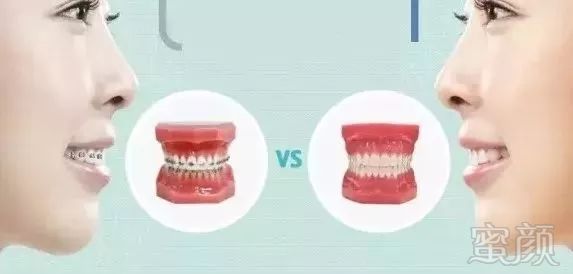https://img.miyanlife.com/mnt/timg/180506/1244404V7-6.jpg
