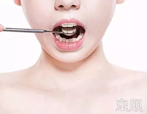 https://img.miyanlife.com/mnt/timg/180506/124440J59-4.jpg