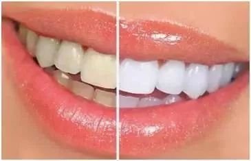 https://img.miyanlife.com/mnt/timg/180506/1244411A3-10.jpg