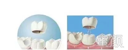 https://img.miyanlife.com/mnt/timg/180506/1244413F9-9.jpg