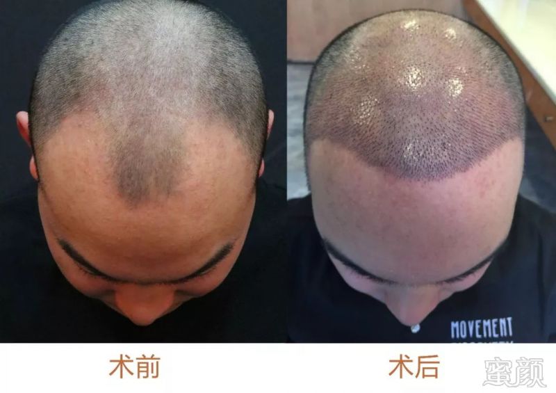 https://img.miyanlife.com/mnt/timg/180506/134209EV-4.jpg