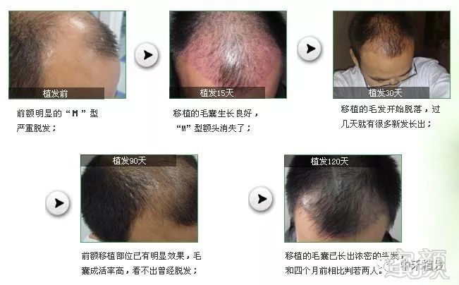 https://img.miyanlife.com/mnt/timg/180506/143I3F95-0.jpg