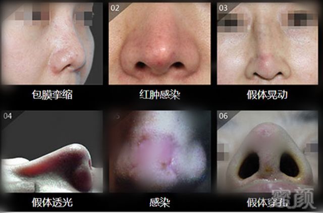https://img.miyanlife.com/mnt/timg/180506/151153HA-3.jpg