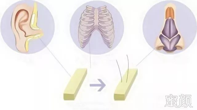 https://img.miyanlife.com/mnt/timg/180506/1512024948-6.jpg