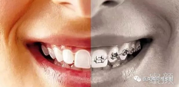 https://img.miyanlife.com/mnt/timg/180506/1516333344-0.jpg