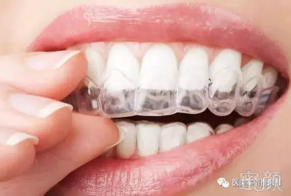 https://img.miyanlife.com/mnt/timg/180506/15163442B-2.jpg