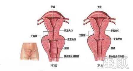https://img.miyanlife.com/mnt/timg/180506/151I91310-2.jpg