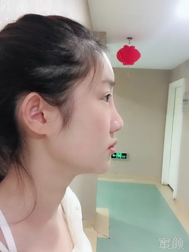 https://img.miyanlife.com/mnt/timg/180506/151K613O-0.jpg