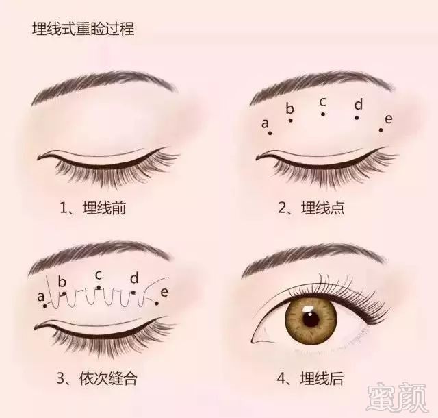 https://img.miyanlife.com/mnt/timg/180506/15551Jc7-4.jpg