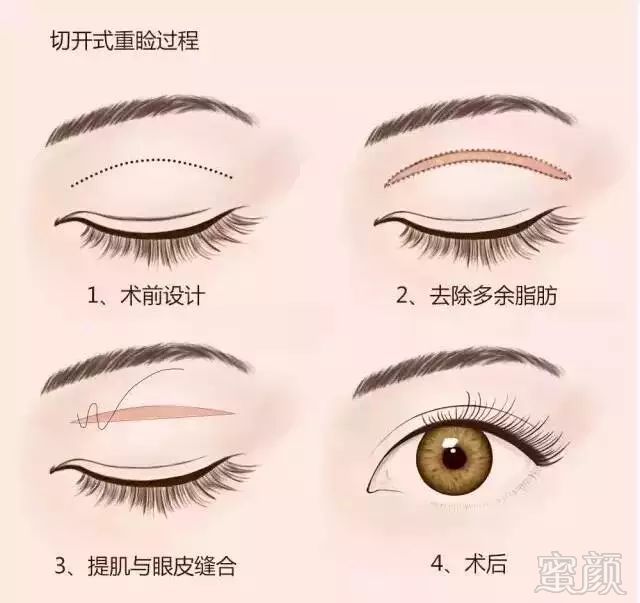 https://img.miyanlife.com/mnt/timg/180506/15551U920-5.jpg