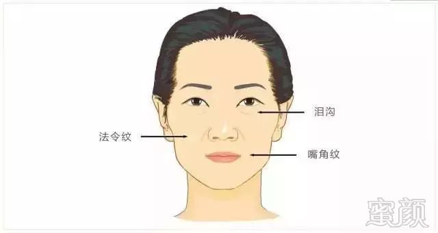 https://img.miyanlife.com/mnt/timg/180507/102952FT-1.jpg