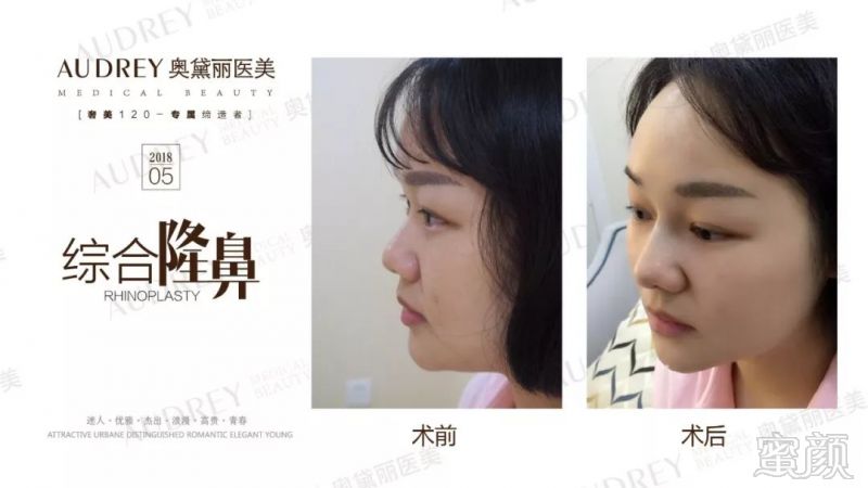 https://img.miyanlife.com/mnt/timg/180507/10533M610-15.jpg