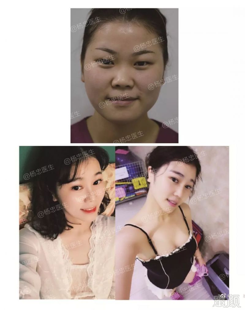 https://img.miyanlife.com/mnt/timg/180507/1115462629-1.jpg