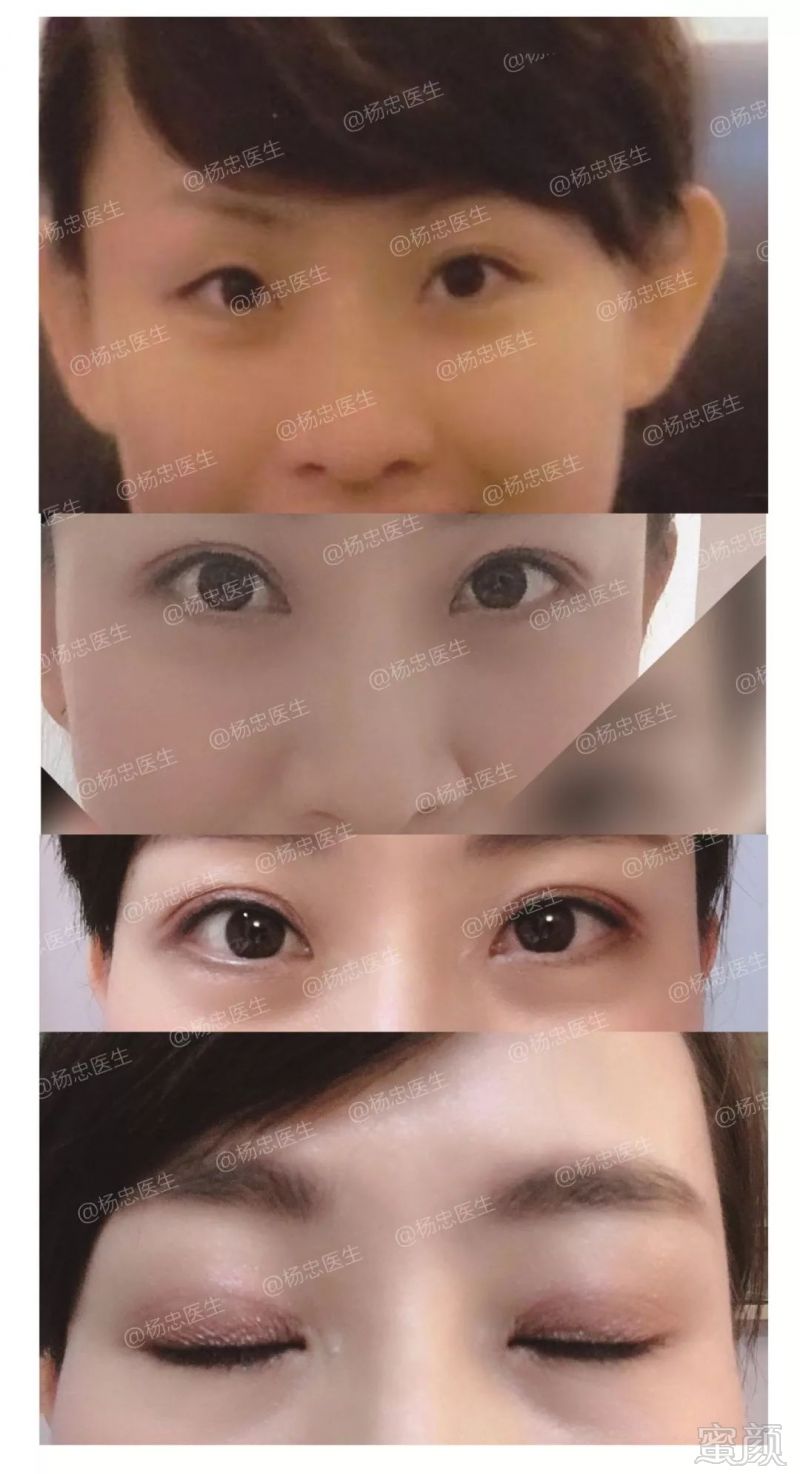 https://img.miyanlife.com/mnt/timg/180507/11154I327-2.jpg
