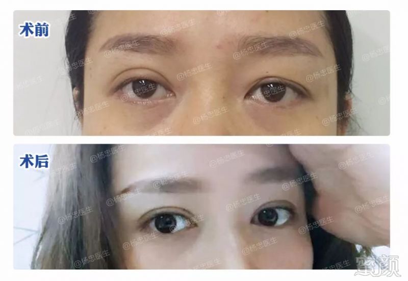 https://img.miyanlife.com/mnt/timg/180507/11155542Q-7.jpg