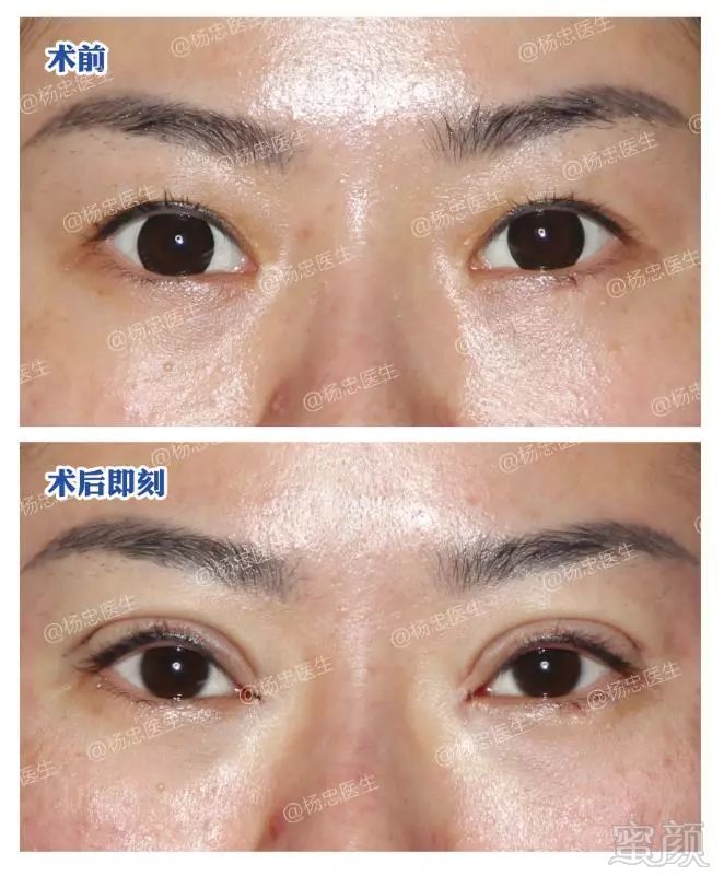 https://img.miyanlife.com/mnt/timg/180507/1115595425-10.jpg