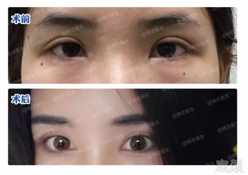 https://img.miyanlife.com/mnt/timg/180507/11155M244-8.jpg