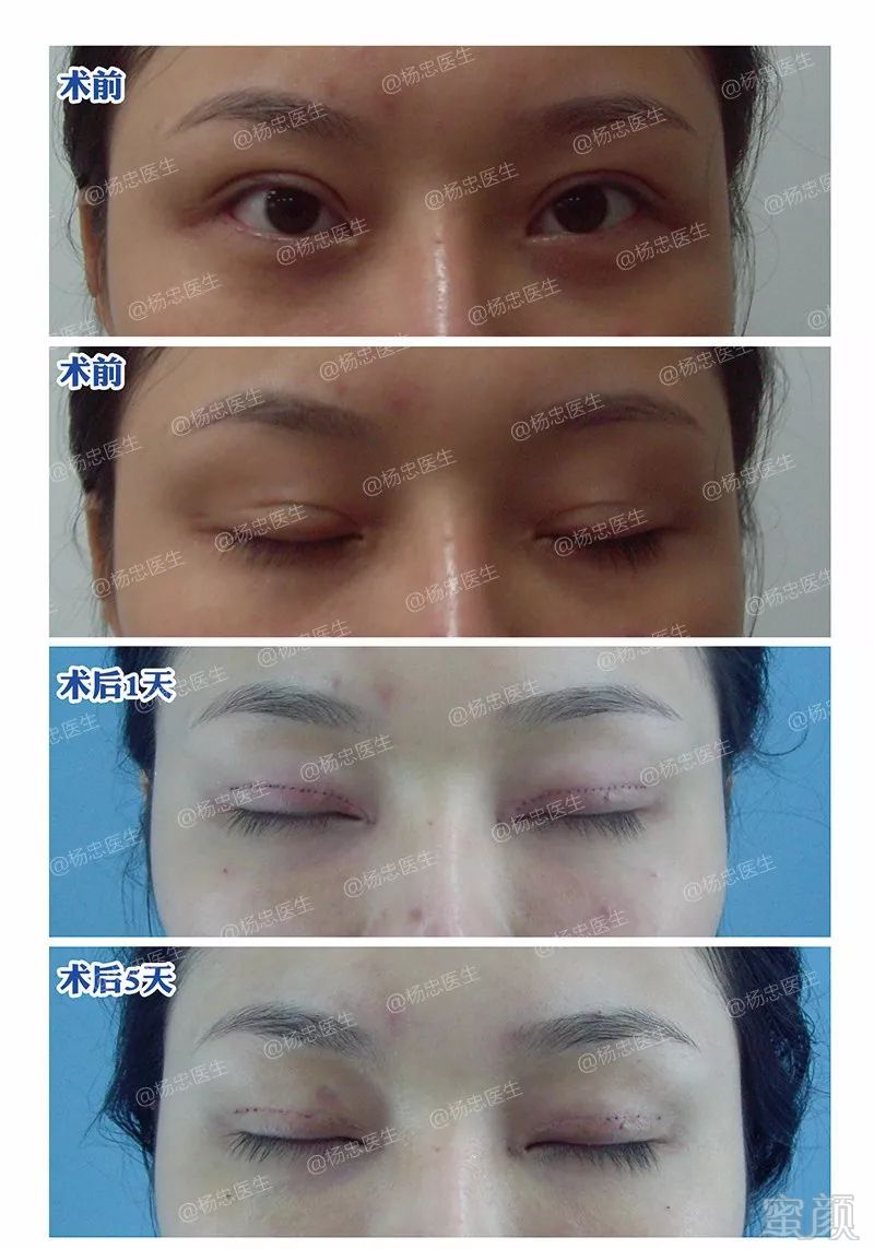 https://img.miyanlife.com/mnt/timg/180507/11155S2S-9.jpg