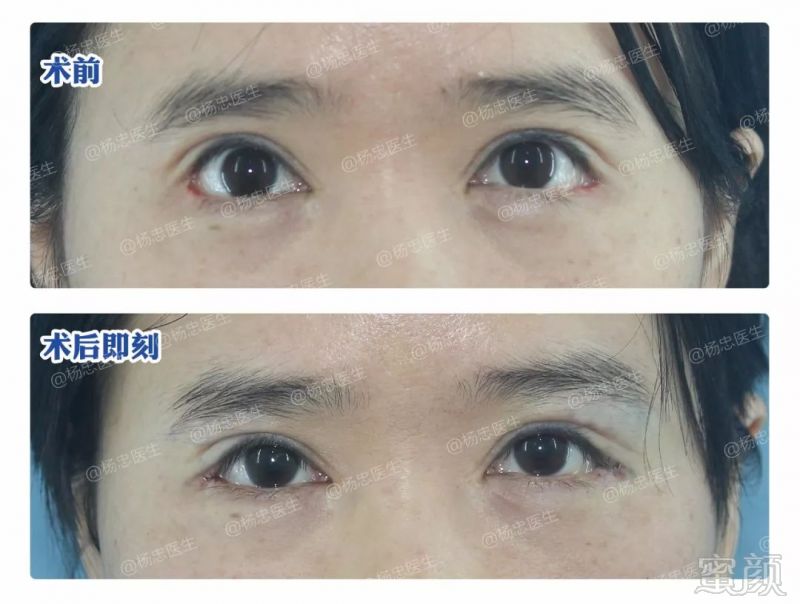 https://img.miyanlife.com/mnt/timg/180507/11160132P-11.jpg