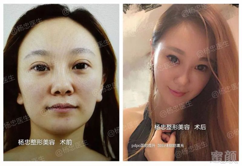 https://img.miyanlife.com/mnt/timg/180507/111601A40-12.jpg