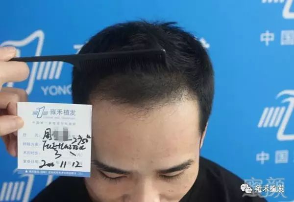 https://img.miyanlife.com/mnt/timg/180507/1144246194-6.jpg