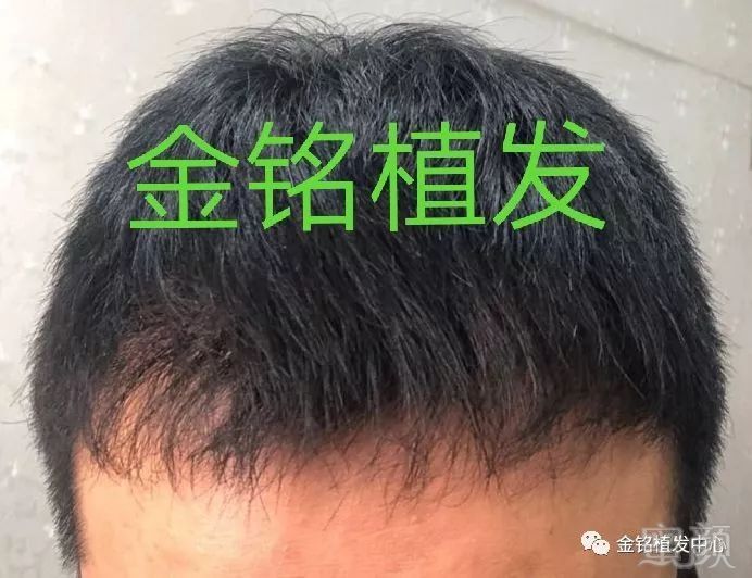 https://img.miyanlife.com/mnt/timg/180507/1145395G2-4.jpg