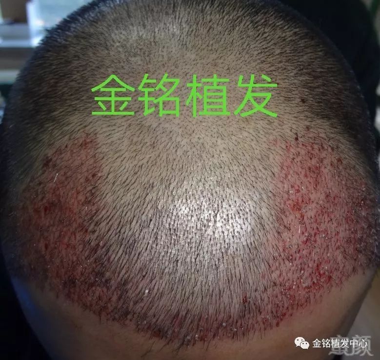 https://img.miyanlife.com/mnt/timg/180507/11453H137-1.jpg