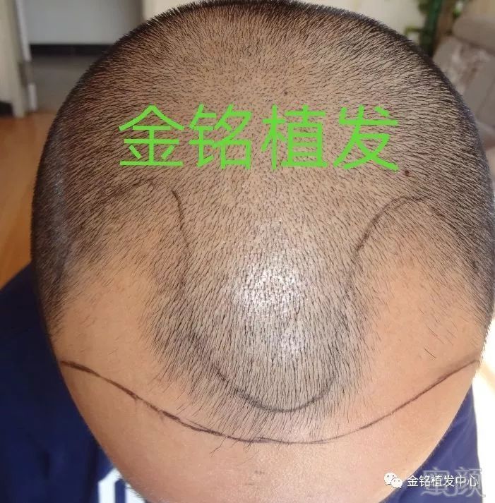 https://img.miyanlife.com/mnt/timg/180507/11453J402-0.jpg