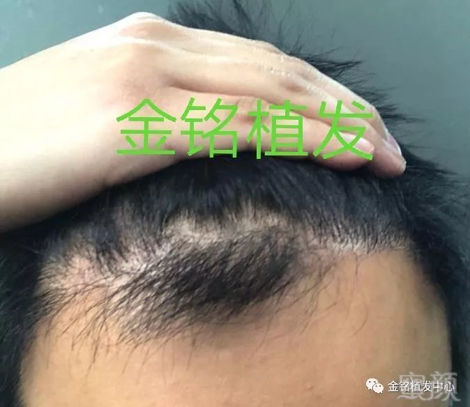 https://img.miyanlife.com/mnt/timg/180507/11453RB2-2.jpg