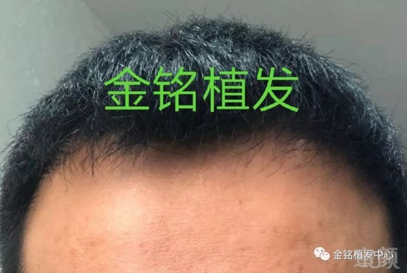 https://img.miyanlife.com/mnt/timg/180507/11453SB7-3.jpg